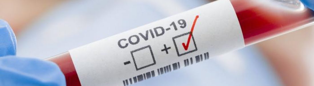 Teve contacto com um caso positivo à COVID-19?